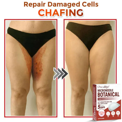 Botanic Skin Tag Removal Patch